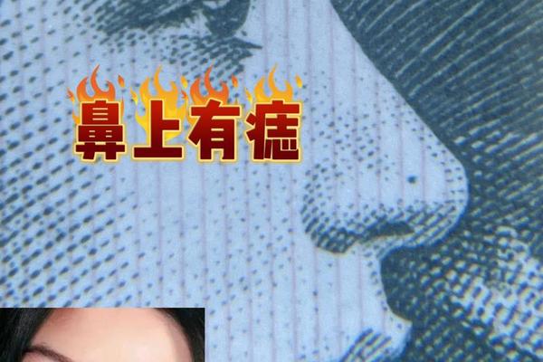 蚂蚁相鼻梁上有痣,鼻梁上有痣的名人