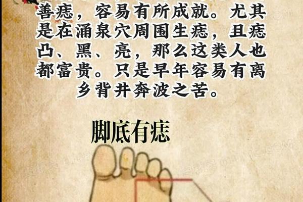 痣相脚部痣相图解大全-脚上长痣 脚上长痣图解