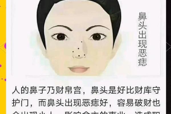 鼻子痣相解析女人_女人鼻梁有痣 鼻子痣相解析女人_女人鼻梁有痣