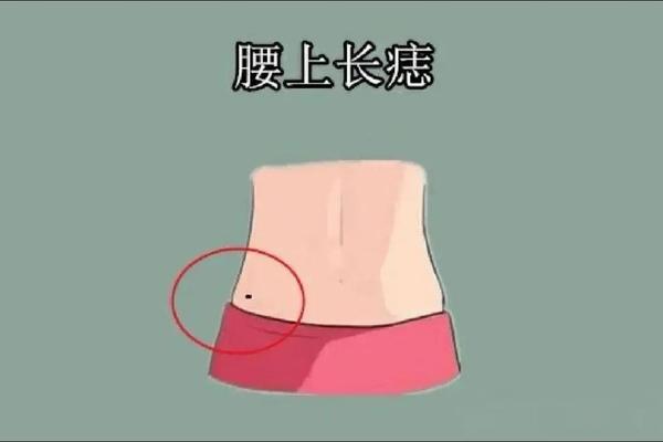 女人右腰上全部痣相说明;女人右侧腰有痣图片