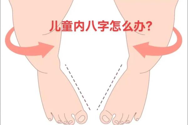 宝宝走路外八字 宝宝走路外八字