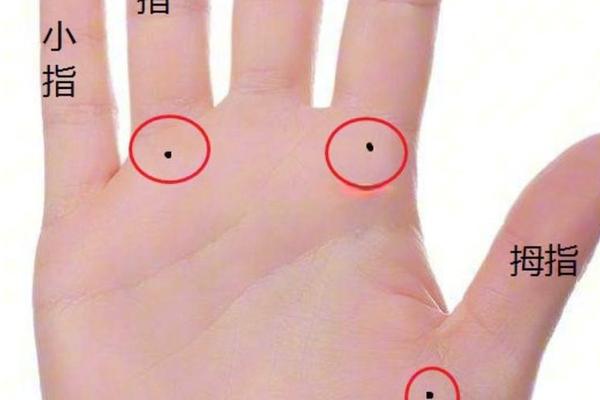 手掌痣的痣相特点 手掌痣相图解