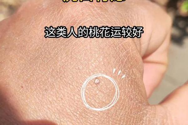 女左手虎口痣痣相(左手虎口长了一颗痣寓意)