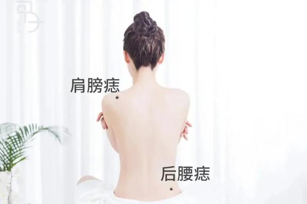 女左腰痣痣相_腰上有个痣好不好 女左腰痣痣相_腰上有个痣好不好