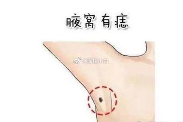 右腋窝痣相;左腋窝痣相图解