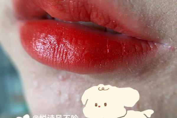 下眼皮痣相红色-眼皮下长了一个红色的点