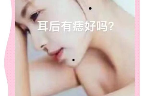 耳后面有痣财相-耳后方有痣代表什么