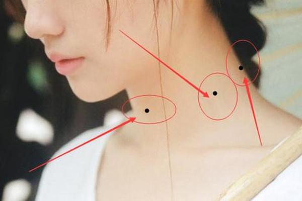 痣相颈部左边有痣;脖子痣的图解大全