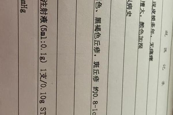 右脚后跟痣相解释(右脚脚后跟有个痣)