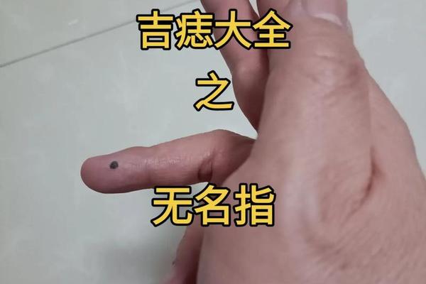 女右手无名指痣痣相_右手无名指长了个痣