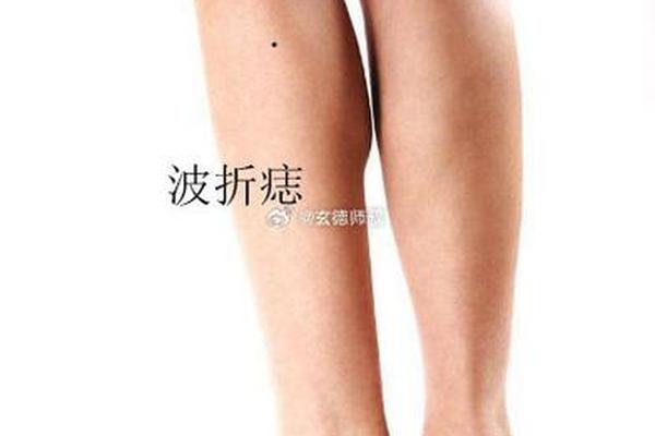 女人大腿中全部痣相说明;大腿有痣代表什么意思