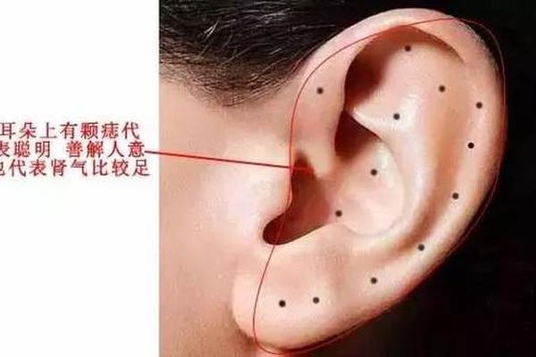 女人嫁富豪的耳垂痣相、耳垂反面有痣图解面相 女人嫁富豪的耳垂痣相、耳垂反面有痣图解面相