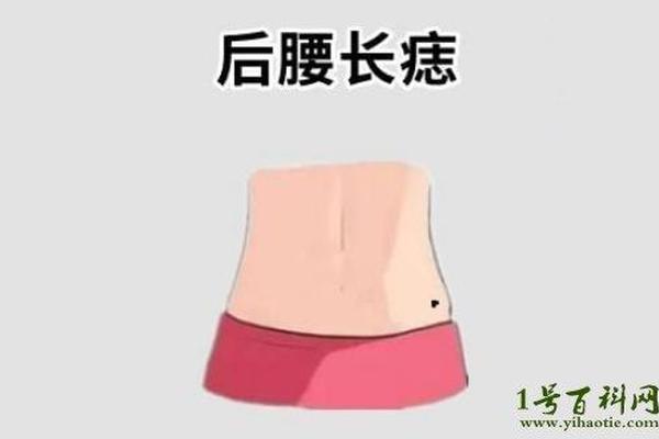 菩萨相痣(哪些痣是菩萨转世)