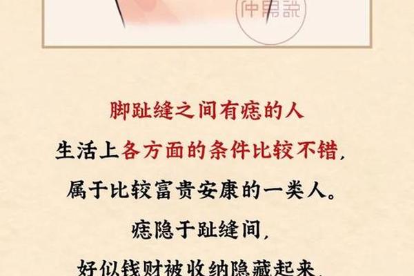 脚痣相男(脚痣相图解大全) 脚痣相男(脚痣相图解大全)
