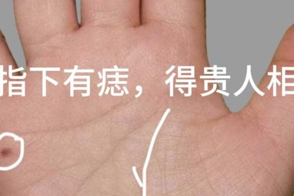 水星线上有玉痣相-水星丘有痣的优点
