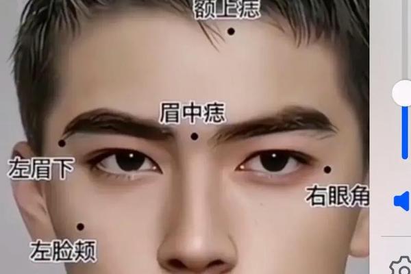 右下巴相痣图解男、右下巴有痣的男人面相