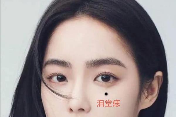 第一相书泪痣-苦泪痣长在哪里图解