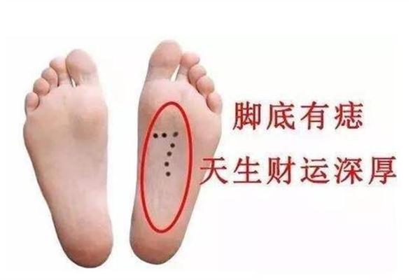 左脚小指缝长痣相说 脚小拇指侧面有痣代表