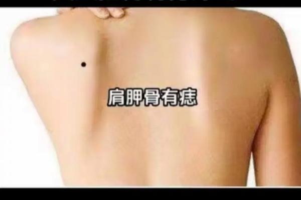 肩膀痣相风水_肩膀有痣图解大全