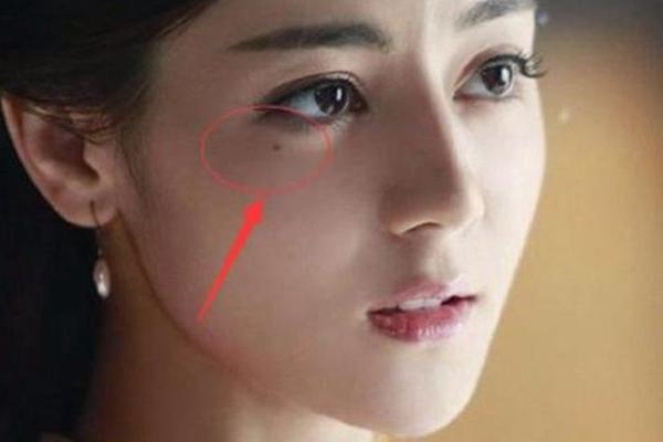 迪丽热巴有痣眼相_迪丽热巴眼角的痣在左边还是右边
