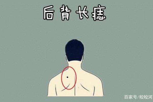 痣相 男性后腰长痣;腰上长痣的男人好不好 痣相 男性后腰长痣;腰上长痣的男人好不好