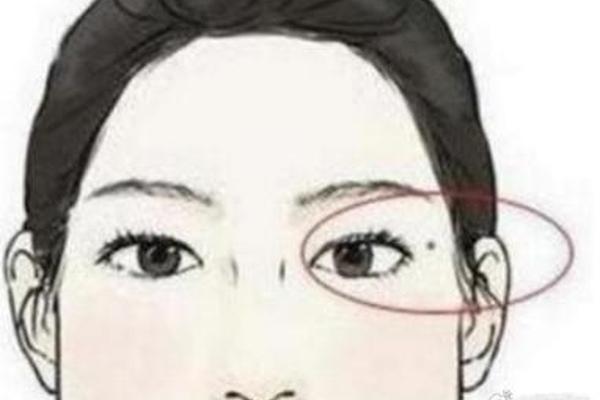 夫妻相有相同的痣—夫妻同一个位置有痣