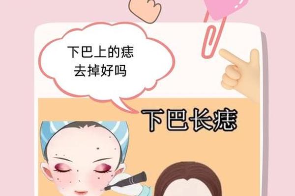 下巴上方嘴唇下方的痣相_嘴下巴痣代表什么