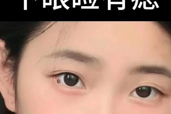 痣相 右眼下方,右眼下方的痣是什么痣