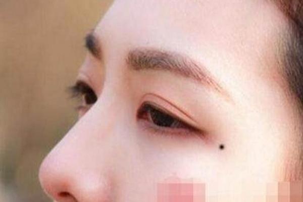 男右眼尾痣相_男生右眼尾有痣