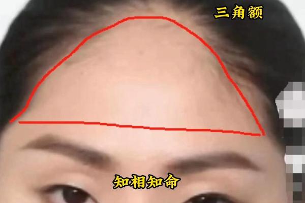 额头上三颗痣有谋反之相,额头三个痣连三角形 额头上三颗痣有谋反之相,额头三个痣连三角形