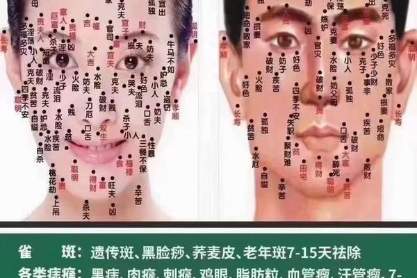 邯郸痣相,邯郸点痣哪个医院好 邯郸痣相,邯郸点痣哪个医院好