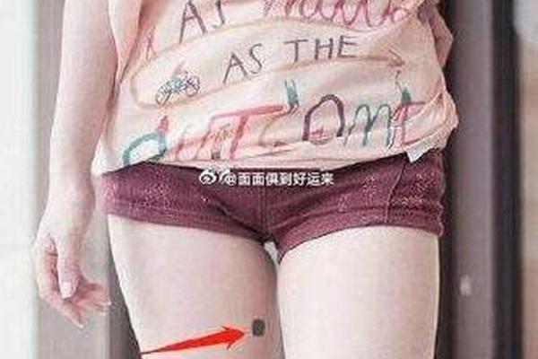 男士大腿痣相_大腿有痣代表什么意思