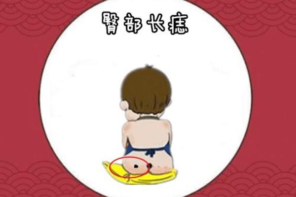 痣相屁股上有痣好不好,屁股上有痣好吗