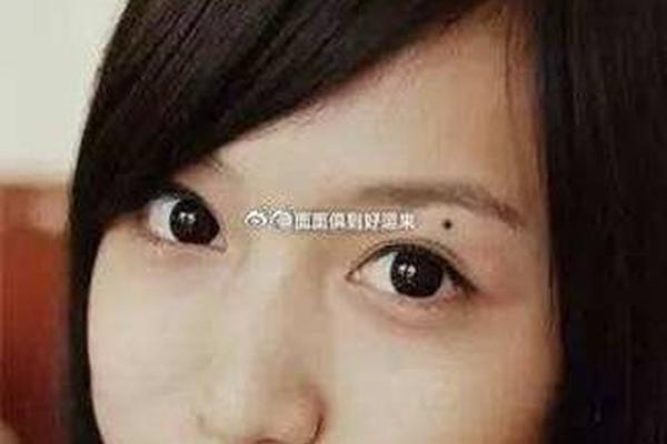 右眉相尾部底有痣-右眉毛尾部有痣代表什么