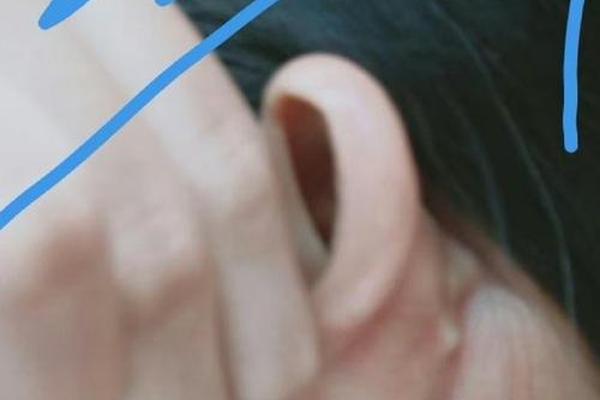 痣相耳朵后痣女孩呢 女人耳朵后痣相最准图