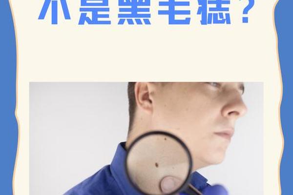 痣相之长黄毛好、脸上长黄毛是什么原因