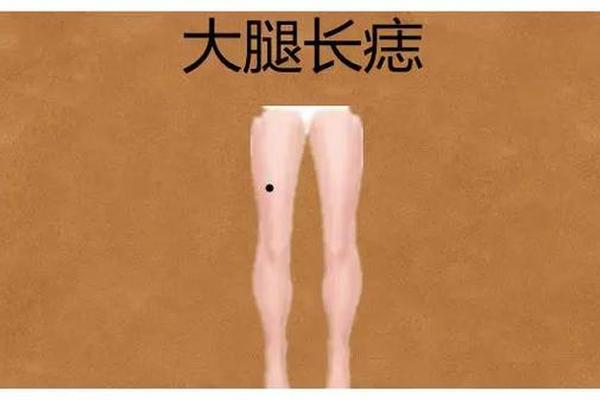 大腿长痣体相,大腿外侧长痣代表什么
