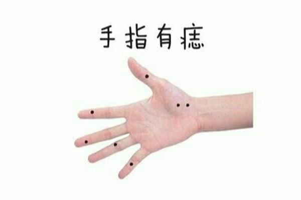 小拇指下方痣相(小拇指下面有个痣)