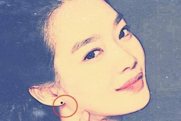 下身女相有一颗痣-女生下面有颗痣象征着什么