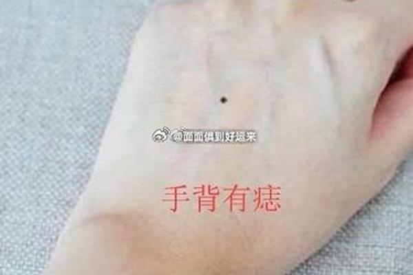 具有领导能力痣相,什么叫领导能力