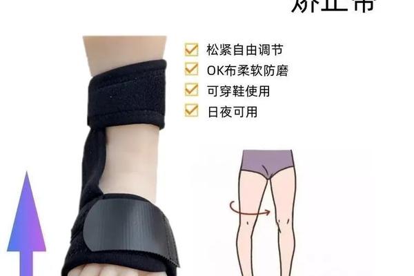 外八字怎么矫正