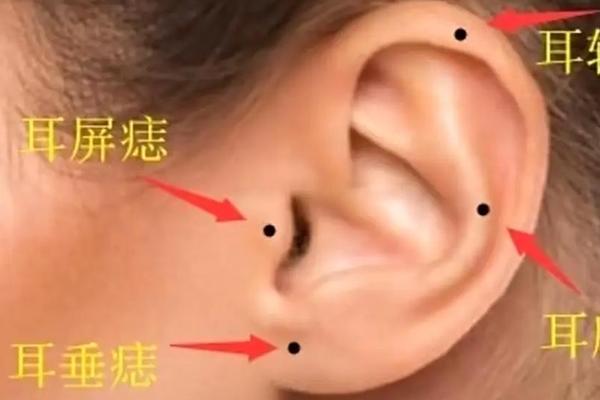 耳内部痣相-耳朵内长痣的位置图解