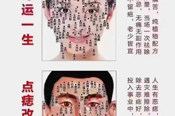 颧骨上的痣相全解看命运,颧骨痣的位置与命运图