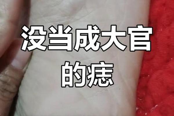 足底有痣为官之相、脚底痣一定会癌变吗