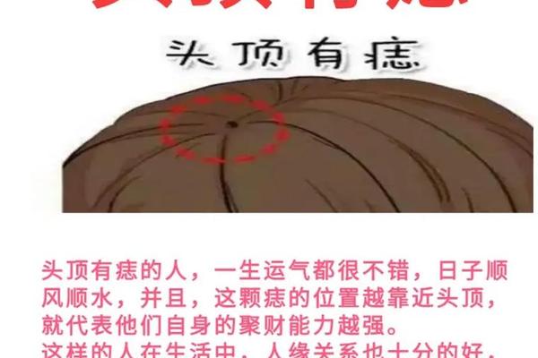有才能的痣相—特别有钱的痣相