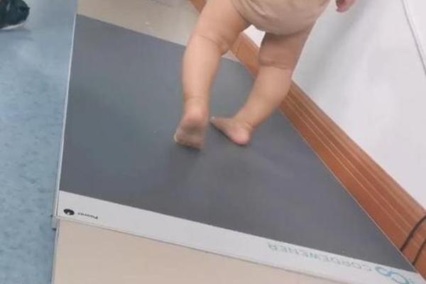 小孩走路内八字 小孩走路内八字