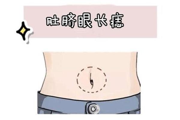 痣相女人肚子上痣相图解-女人痣相图解