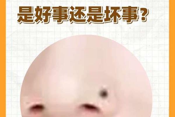 女相鼻翼有痣好不好、鼻翼旁边有痣代表什么女面相 女相鼻翼有痣好不好、鼻翼旁边有痣代表什么女面相