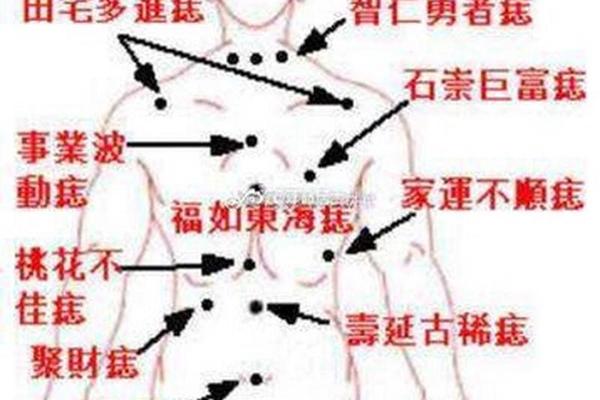 老年痣相-老年痣是什么引起的