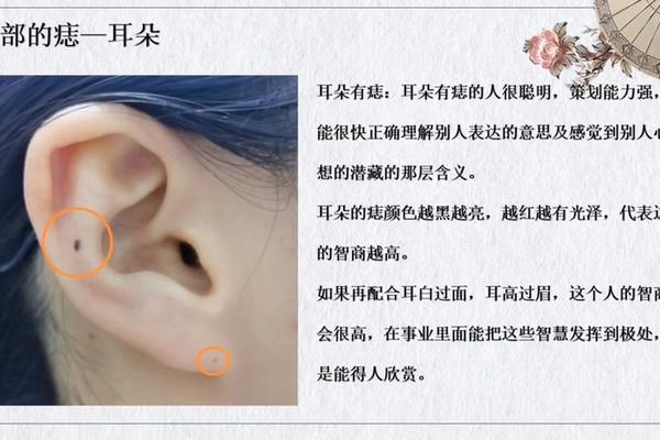 耳朵相痣图解大全_耳朵上的痣命相图解 耳朵相痣图解大全_耳朵上的痣命相图解